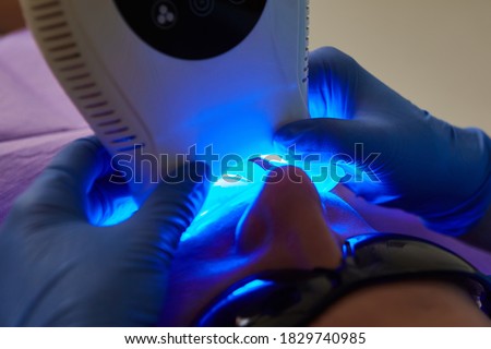 Close-up portrait of a female patient at dentist in the clinic. Tooth filling ultraviolet lamp. Shallow dof.