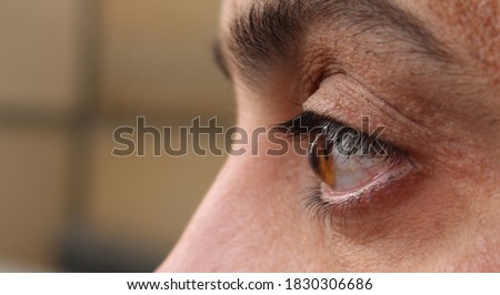 Macro eye photo. End stage of keratoconus. Keratoconus - eye disease, thinning of the cornea in the form of a cone.  Royalty-Free Stock Photo #1830306686