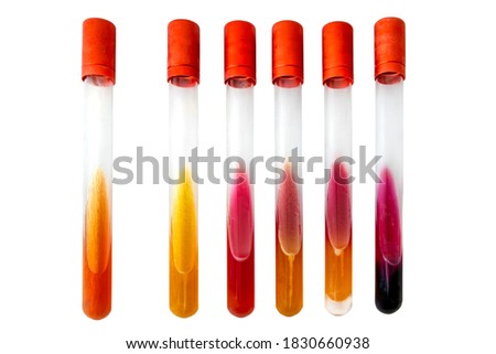 
Bacterial Biochemical Identification tests in tubes with slant medium. Microbiology examination isolated o white background. Royalty-Free Stock Photo #1830660938