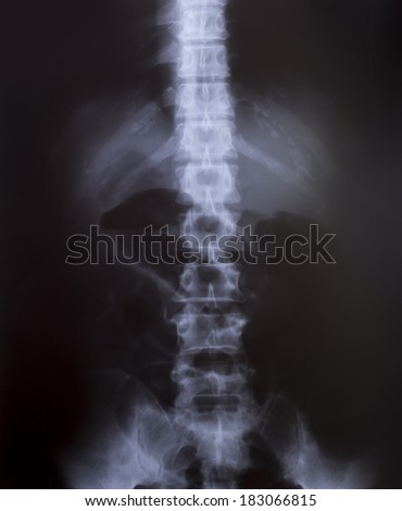 X-Ray Image Of Human for a medical diagnosis