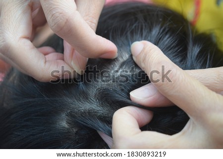 a mother is looking for head lice on her child
