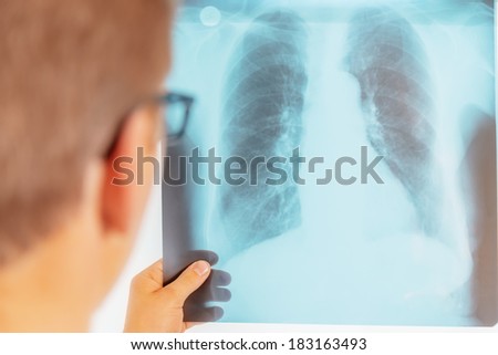 Man doctor looks at x-ray image of lungs in a hospital, rear view