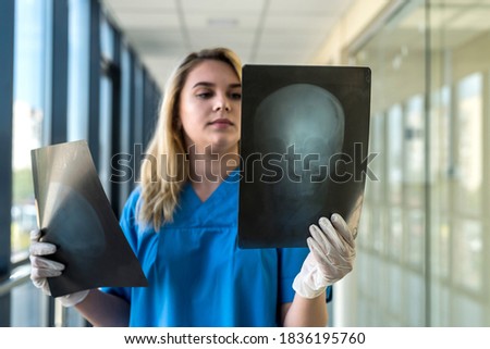 medical worker looks at xray film of the skull to detect signs of the disease. health