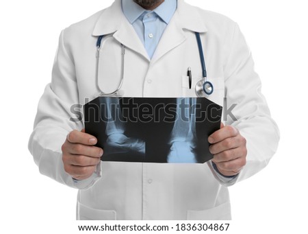 Orthopedist holding X-ray picture on white background, closeup