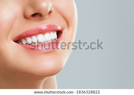 Perfect healthy teeth smile of a young woman. Teeth whitening. Dental clinic patient. Image symbolizes oral care dentistry, stomatology. Royalty-Free Stock Photo #1836328822