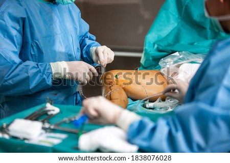 Process surgery of varicose veins in the operating room in a hospital, healtcare concept