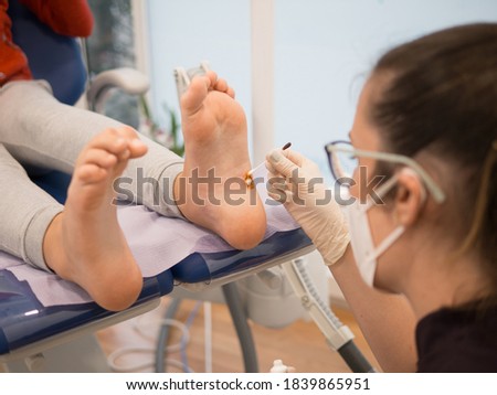 Female podiatrist treating a verrucas on a patients foot Royalty-Free Stock Photo #1839865951