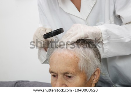 Doctor examining senior woman's hair scalp, scalp eczema, dermatitis, psoriasis, hair loss, dandruff or dry scalp problem