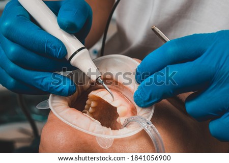 The dentist removes tartar using ultrasound, the patient at the dentist. Retractor for isolation of lips and gums. Royalty-Free Stock Photo #1841056900