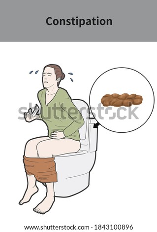 
Medical illustration for explanation Constipation
