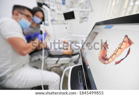 Dentist scanning patient's teeth with modern scanning machine. Digital print of patient's teeth is on big screen. Modern high precision technologies. Concept of modern dentistry Royalty-Free Stock Photo #1845499855