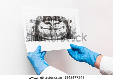 Doctor's hands in protective medical gloves are holding and examining an x-ray picture of teeth on a white background