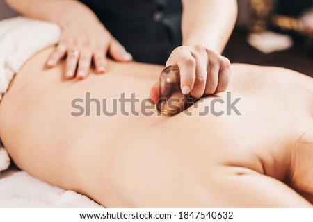 Back massage with vacuum cups - a professional masseur treats a patient Royalty-Free Stock Photo #1847540632