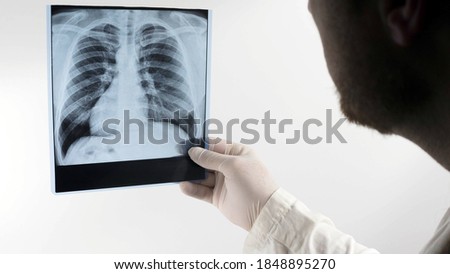 X-ray of the lungs on a white background close-up, shot of the lungs of a person.