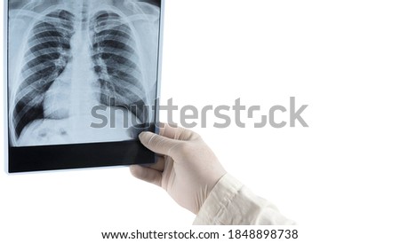 X-ray of the lungs isolated on white place for text, close-up, image of human lungs, doctor analyzes the picture of the lungs.
