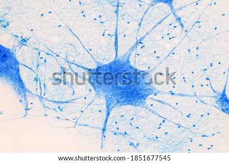 Motor Neuron under the microscope in Lab.
 Royalty-Free Stock Photo #1851677545