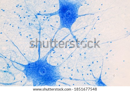 Motor Neuron under the microscope in Lab.
 Royalty-Free Stock Photo #1851677548