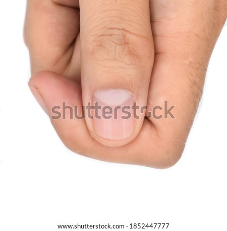 Large lunulae or half-moon at thumb fingernail with longitudinal lines of Southeast Asian, Chinese young man. Isolated on white background. Royalty-Free Stock Photo #1852447777