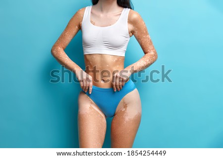 Image of unrecognizable woman has perfect figure has skin problems wears dressed in cropped top and panties isolated over blue background