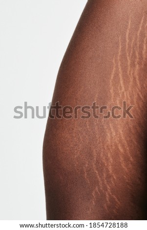 White freckles on brown skin natural complexion closeup