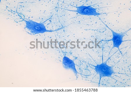 Motor Neuron under the microscope in Lab.
 Royalty-Free Stock Photo #1855463788