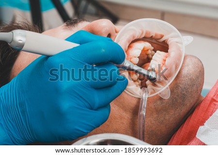 patient removing tartar,the dentist uses ultrasound to remove tartar,dental scaler. Royalty-Free Stock Photo #1859993692