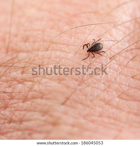 Deer Tick (Ixodes scapularis) on human skin Royalty-Free Stock Photo #186045053