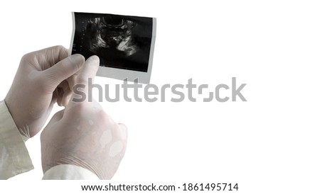 A snapshot of a prostate is isolated on a white background in the hands of a medical professional a picture of a male prostate.