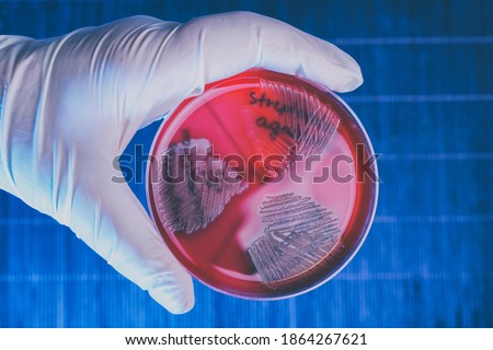 Hand in glove holding Petri plate with bacteria Steptococcus Phaemolifticus G, Streptococcus Agalactiae, Streptococcus Phaemolifticus Royalty-Free Stock Photo #1864267621