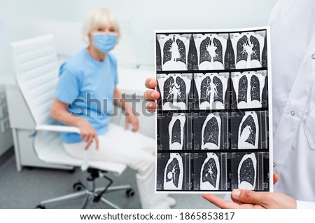 Pulmonologist showing CT scan of lungs elderly patient with pneumonia. Complication after coronavirus. Lung disease, pulmonary fibrosis Royalty-Free Stock Photo #1865853817