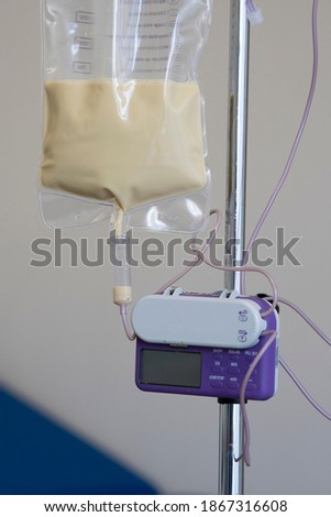 Feeding Pump medical device purple color to supplement nutrition liquid food to tube enteral feeding fluid set bag with clamp hanging on stand. Royalty-Free Stock Photo #1867316608