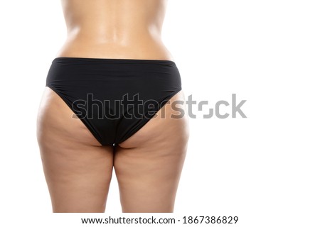 Back view. Overweight woman with fat cellulite legs and buttocks, obesity female body in black underwear isolated on white background. Orange peel skin, liposuction, healthcare and beauty treatment.