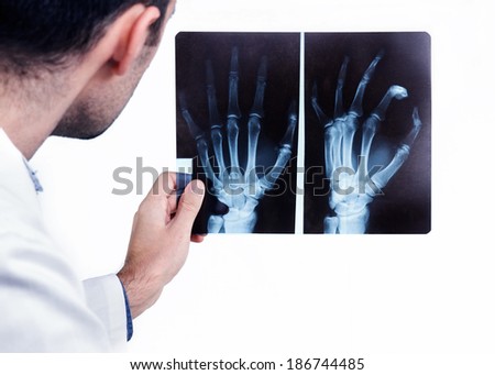 Doctor looking at the x-ray picture of hand.