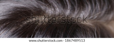 Black and gray hair on head. Early gray hair and its causes concept