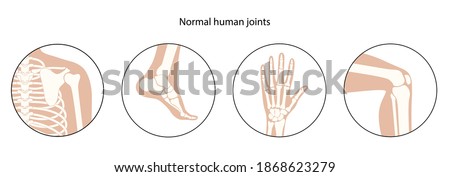 Set with human shoulder, knee, ankle and wrist icons. Normal joints and bones medical poster for clinic. Orthopedic or chiropractic treatment. Anatomical logo concept. Skeleton vector illustration. Royalty-Free Stock Photo #1868623279