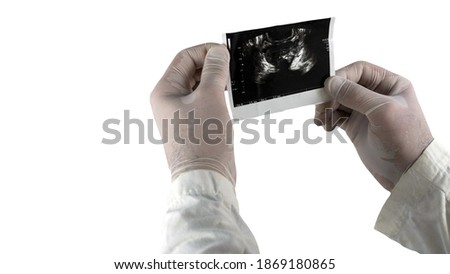 Ultrasound of the prostate at the doctor's hands, a picture of a male prostate, on a white background