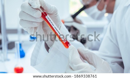 close up. lab technician making a mark on the tube with the test.