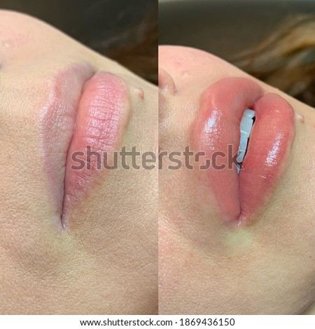 Lip blush tattoo treatment before and after Royalty-Free Stock Photo #1869436150