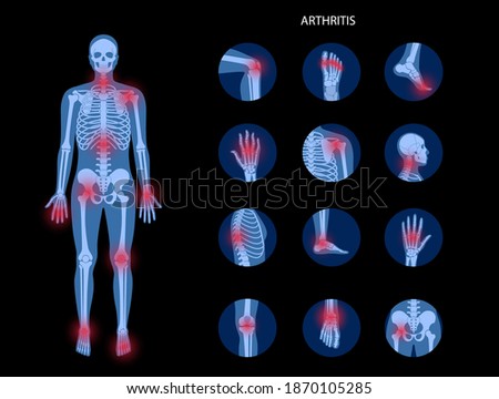 Pain in male human body. Man skeleton silhouette. Spine, knee, other joint icons. Arthritis, inflammation, fracture, bone structure and cartilage concept. Medical poster. Flat xray vector illustration Royalty-Free Stock Photo #1870105285