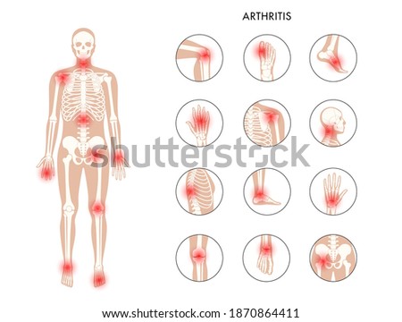 Pain in human body. Male skeleton silhouette. Spine, knee and other joint icons. Arthritis, inflammation, fracture, bone structure and cartilage concept. Medical poster. Flat xray vector illustration Royalty-Free Stock Photo #1870864411