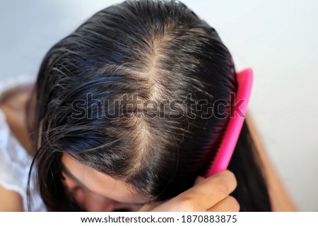 Woman serious thin hair problem for health care.