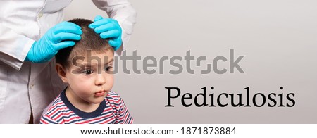 The pediatrician in the gloves will check the presence of lice and nits in a small child in kindergarten, preventive examination of the head and hair. Banner with the inscription Pediculosis