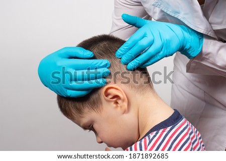 The pediatrician in the gloves will check the presence of lice and nits in a small child. Pediculosis in kindergarten, preventive examination of the head and hair.