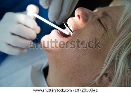 The dentist uses numbing medicine to remove a decayed tooth from a mature female patient in the dental office.