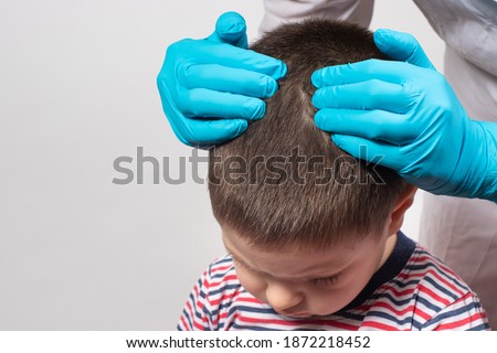 The pediatrician in the gloves will check the presence of lice and nits in a small child. Pediculosis in kindergarten, preventive examination of the head and hair.