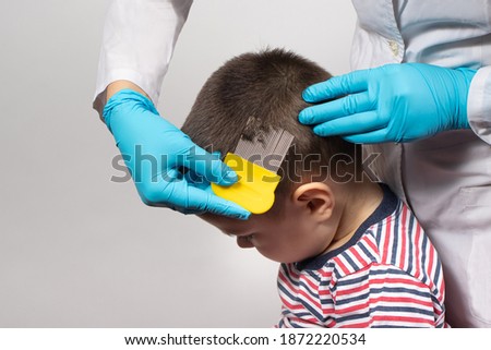 The doctor checks the presence of lice in a small child with the help of a crest. Pediculosis in kindergarten, preventive examination. Removing louse and nits from the hair.