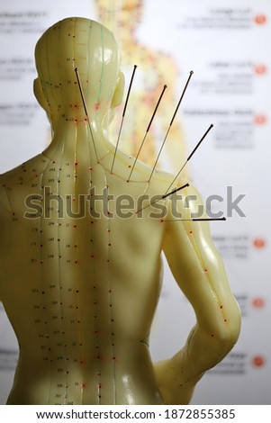 male acupuncture model with needles in the right shoulder