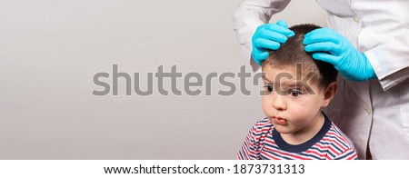 The pediatrician in the gloves will check the presence of lice and nits in a small child. Pediculosis in kindergarten, preventive examination of the head and hair. Banner copy space for text