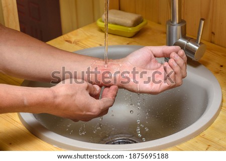 A man washes an abrasion on his arm under running water Royalty-Free Stock Photo #1875695188