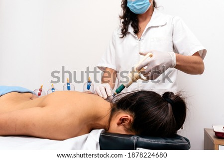 Stock photo of unrecognized woman receiving cupping treatment on her back while lying on stretcher.